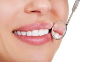 Invisalign