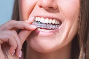 woman wearing invisalign