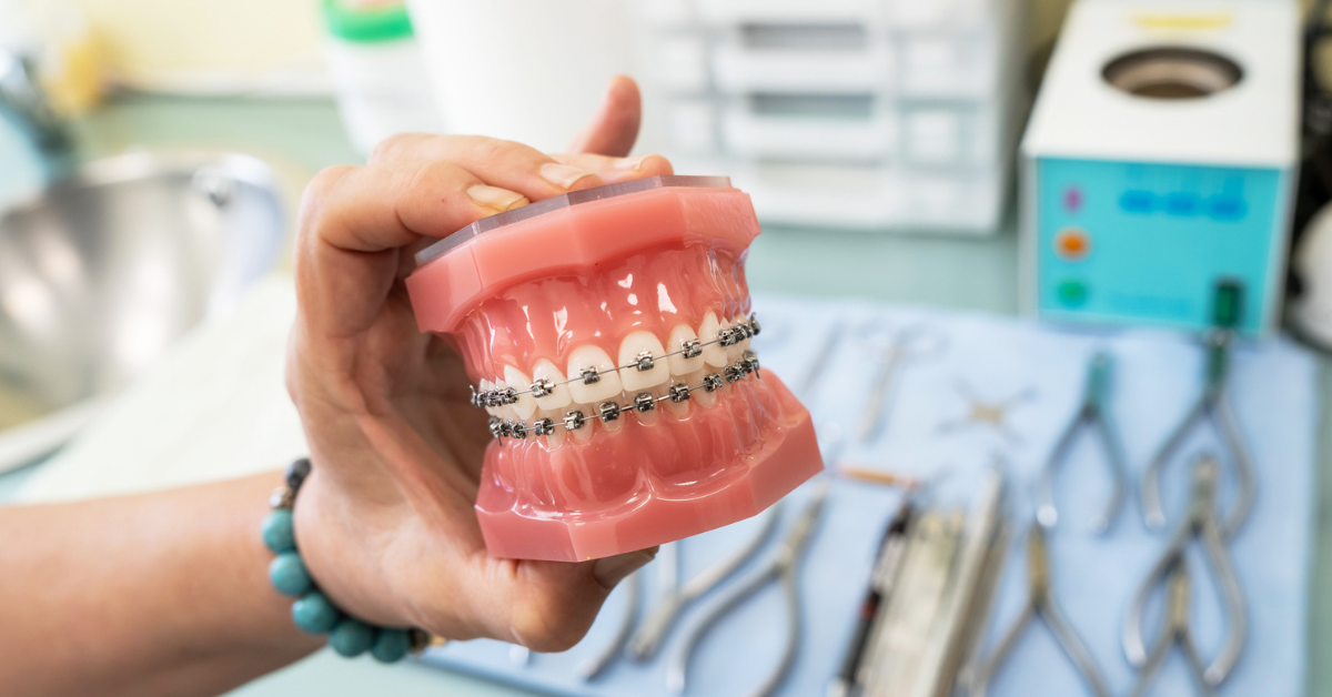 Gapped Teeth and Crossbites When Smile Confidence and Bite Function Matter