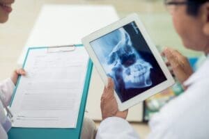 Close-up of doctors examining skull x-ray