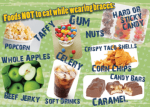 Parker Orthodontics - Foods not to eat while wearing braces