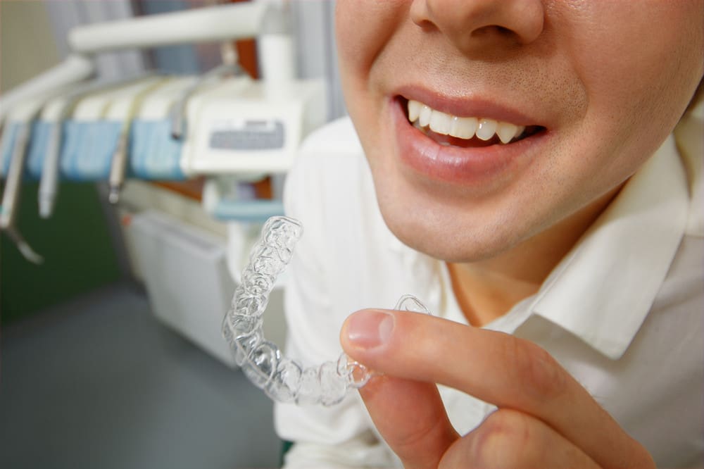 Invisalign aligners